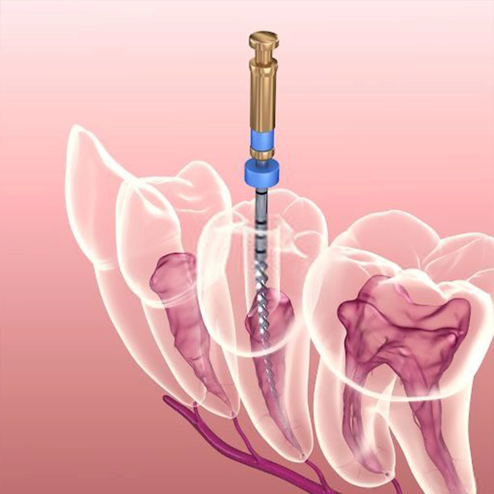 Endodontics